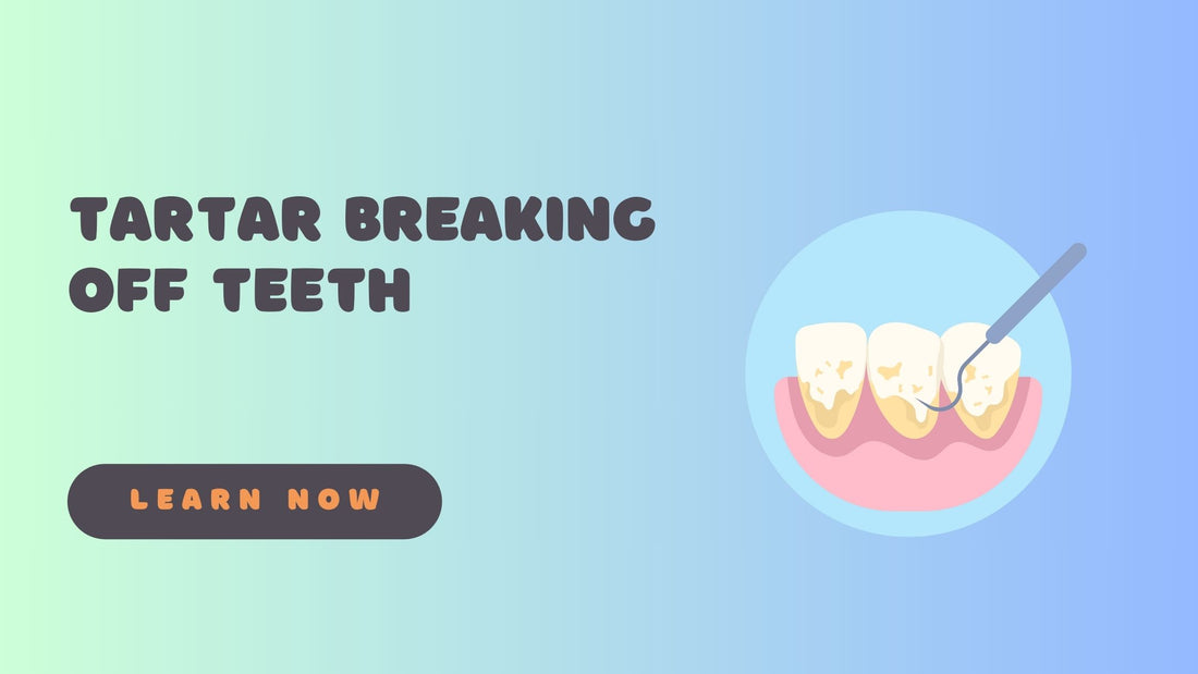 Tartar Breaking Off Teeth