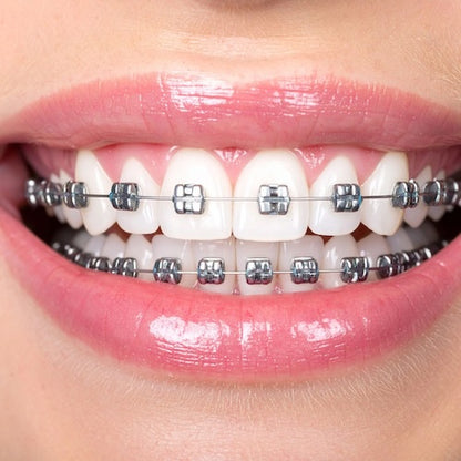 Cordless Water Flosser: Advanced Dental Plaque Remover