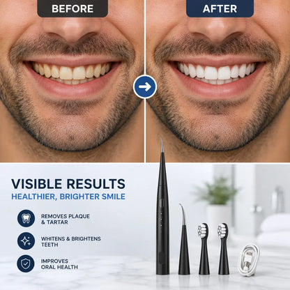 Ultrasonic Teeth Cleaner & Toothbrush | Professional Dental Scaler for Home Use ⭐